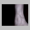 Setup1_wrist7_7in.jpg
