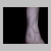 Setup1_wrist_8in.jpg